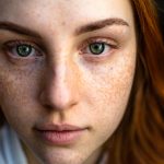 Understanding Acne: Nutrition’s Role in Skin Health and Success