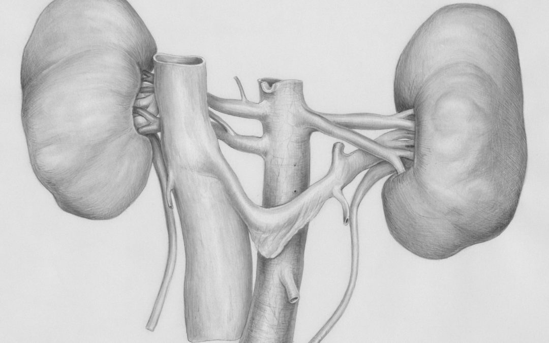 Understanding Kidney Stones and How to Prevent Them