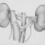 Understanding Kidney Stones and How to Prevent Them